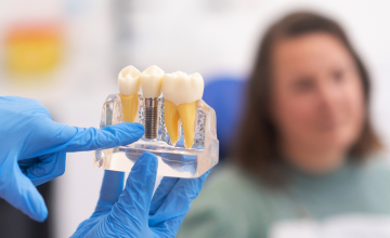 Dental Implants